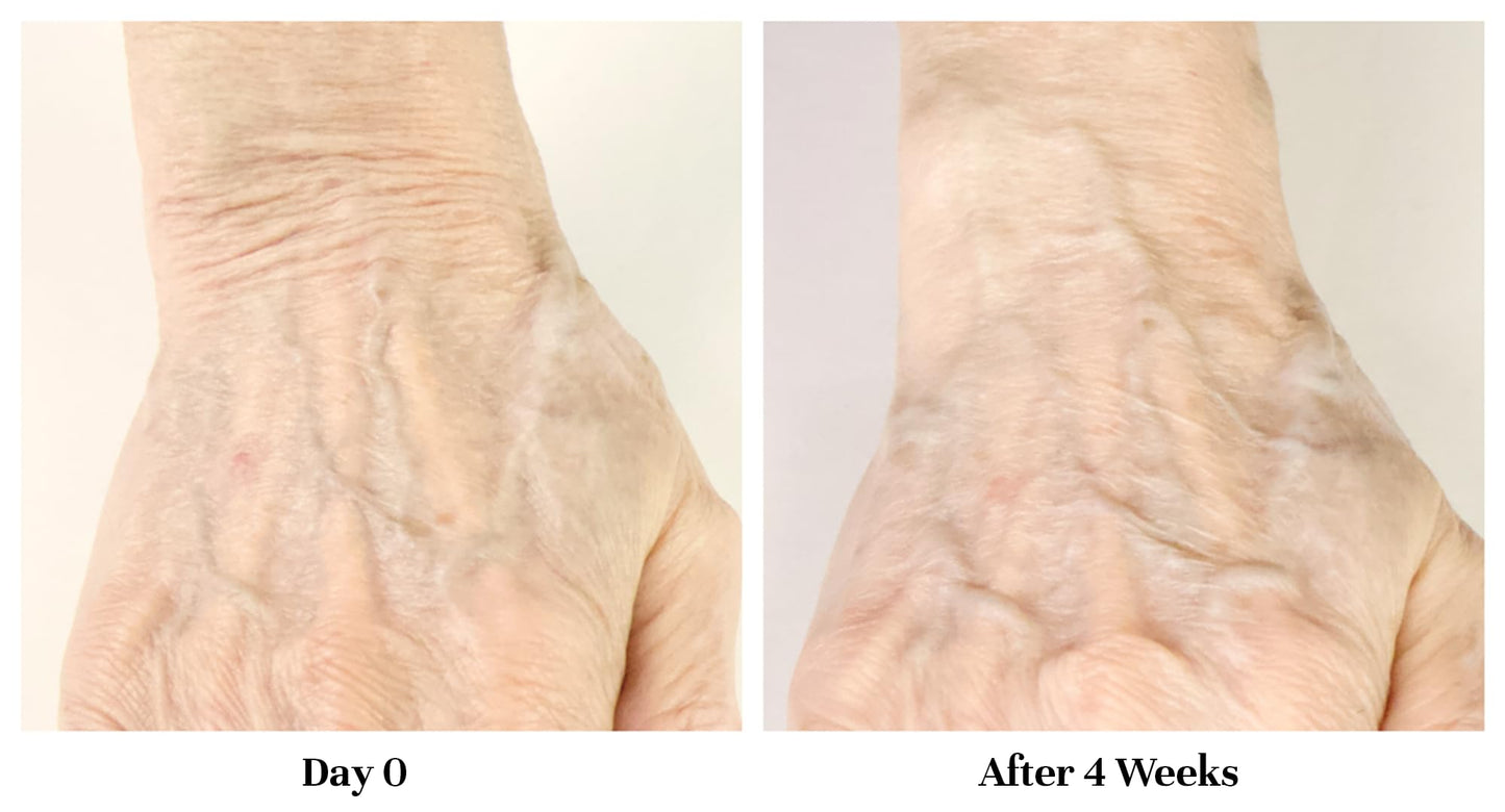 City Beauty Restoring Hand Treatment - Moisturizing Hand Cream - Dry Hand Relief - Solution for Wrinkled, Crepey Hands & Dark Spots - Wash-Resistant - Anti-Aging Cruelty-Free Skin Care